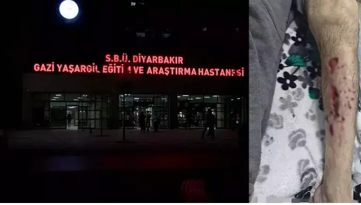 Sokak köpeğinin saldırısına uğradı, bacağına 25 dikiş atıldı