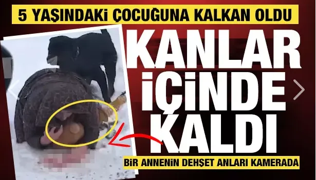 Köpek anne ve çocuğuna saldırdı! Cesur annenin zor anları