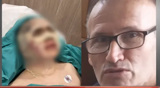 Kendisi reddeden kadına kezzapla saldırdı iki gözünü kör etti