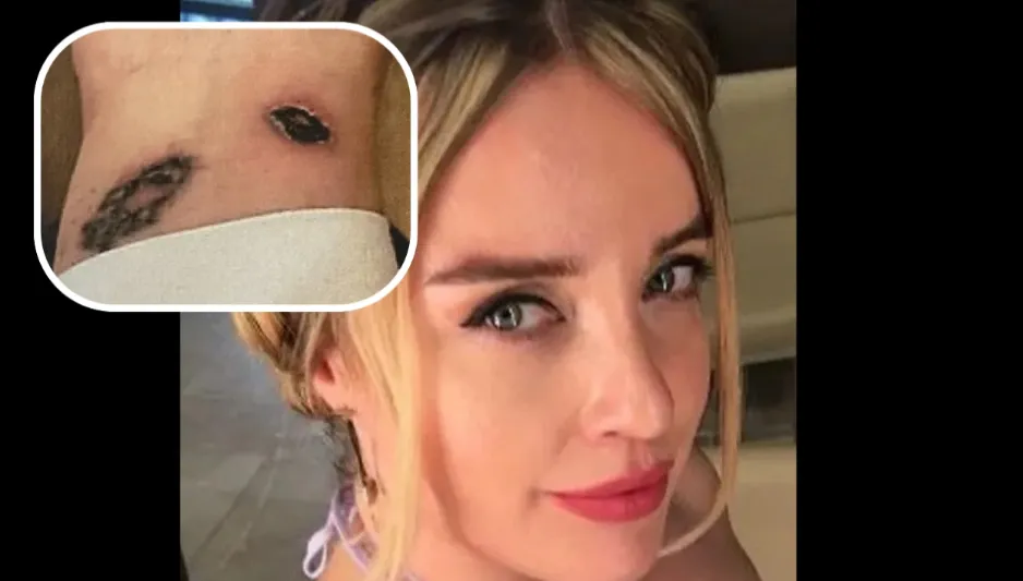 Dövmelerini sildirmek için gittiği klinikte kabusu yaşadı!